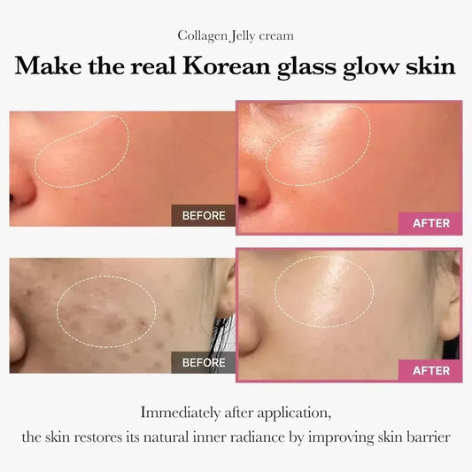 ZenMask Collagen Jelly Face Cream